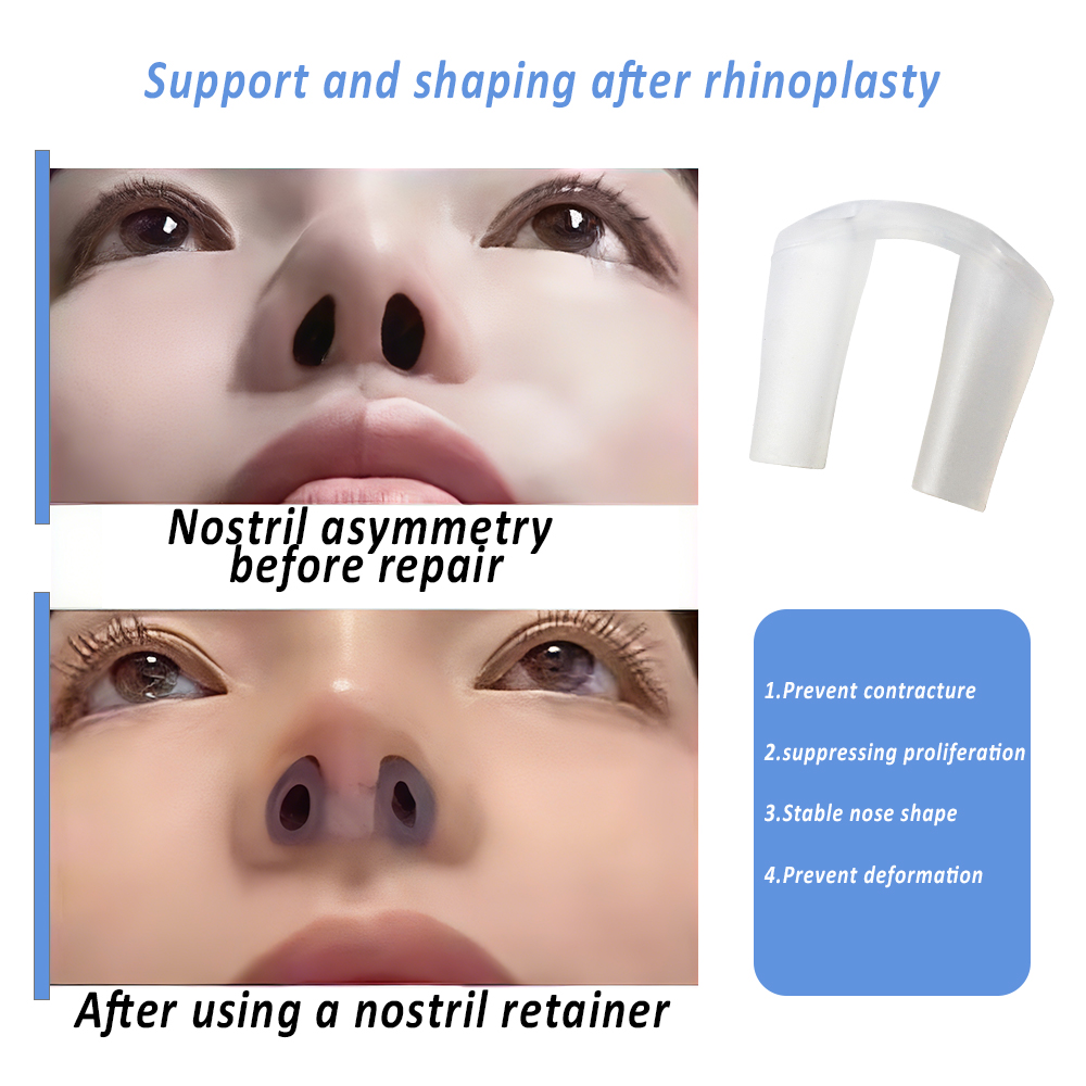코 성형 수술 후용 부드러운 실리콘 코 고정기, 코 모 - Anti Snore Contour Pillow 리뷰 및 가격